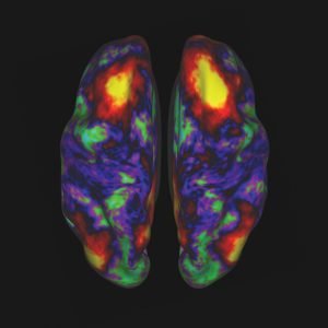 MRI Brain Activity Scan
